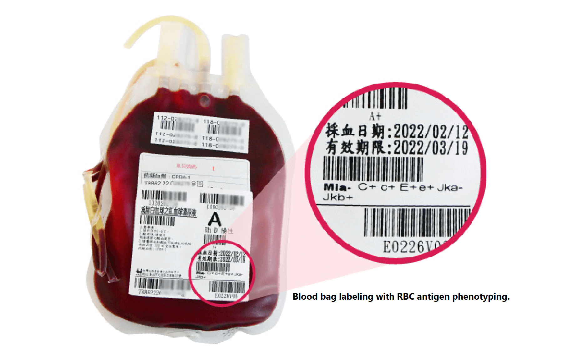 The diagram provides an example illustration of blood bag labeling: the blood bag comprehensively displays 7 blood type antigens.